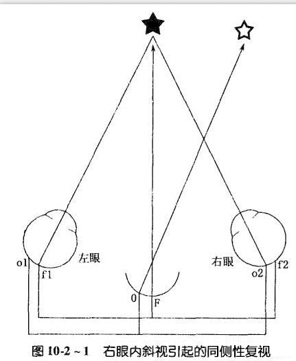 复视像图解图片